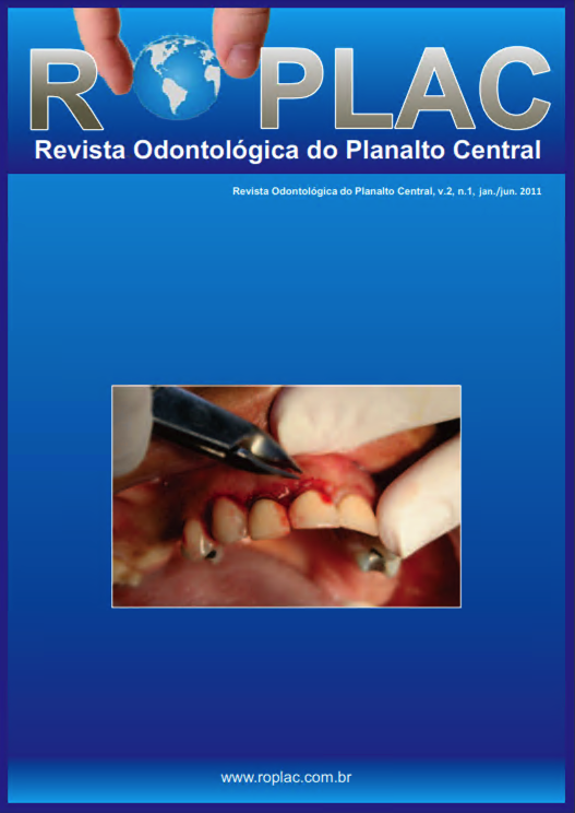 					Visualizar v. 2 n. 01 (2012): Revista Odontológica do Planalto Central Volume 2, Número 1 (2012)
				